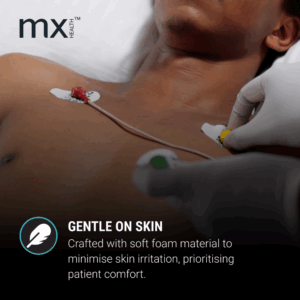 Mx Disposable Ecg Electrodes Pregel Ag/Agcl Sensor